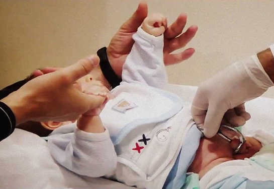 Sünnet Sonrası Bakım Nasıl Yapılır?