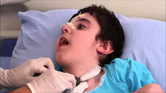 Trakeostomi Bakımı Nasıl Yapılır?